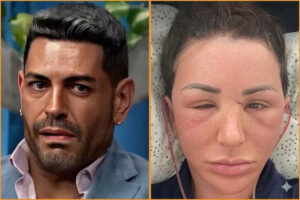 Shekinah Garner Finally Has Her Dream Face in 2026 After Undergoing Multiple Successful Plastic Surgeries Shekinah Garner Finally Has Her Dream Face in 2026 After Undergoing Multiple Successful Plastic Surgeries